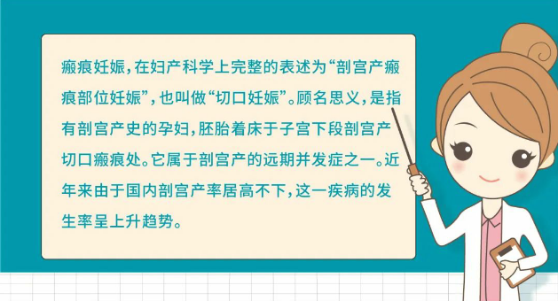 懷孕13周發(fā)現(xiàn)瘢痕妊娠！安琪兒婦科團隊為她拆除身體里的這顆“定時炸彈”