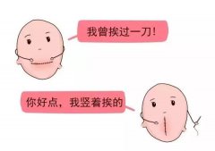 安琪兒孕育精品課|一胎剖了，二胎想順產(chǎn)，來聽