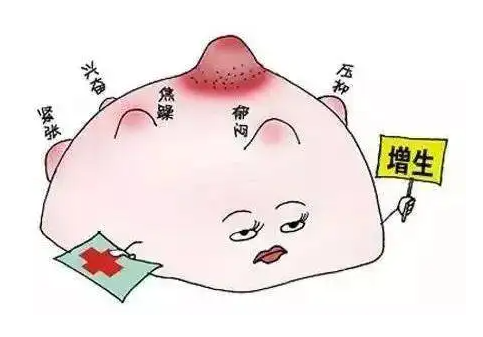 重慶女性患乳腺增生有哪些癥狀表現(xiàn)