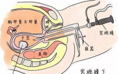 婦科宮腹腔鏡 丨 一種讓女性不再害怕手術(shù)的微創(chuàng)技術(shù)