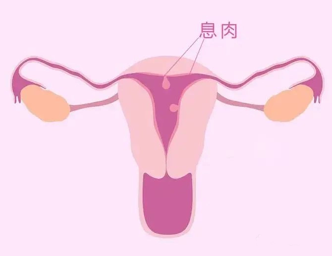 千萬別忽視求子路上的這個“攔路虎”！